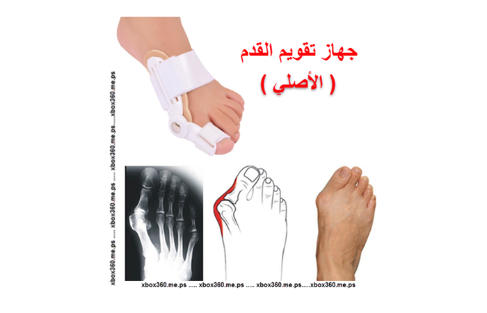 جهاز التقويم للقدم