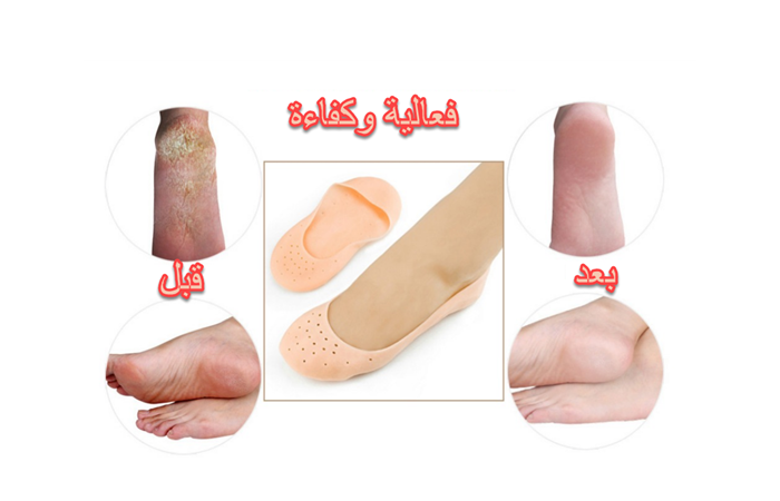 جوارب السيليكون ( الاصلي) معالجة التشققات و نعومةالقدم كاملا [2 قطع]